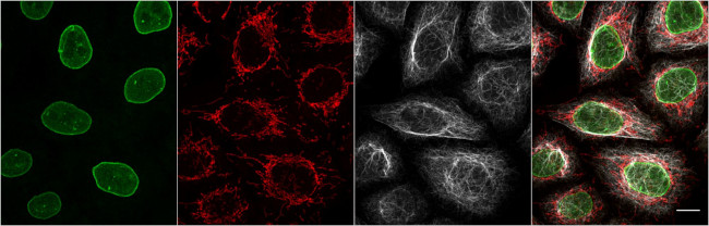 Mouse IgG1 Nano (VHH) Secondary Antibody in Immunocytochemistry (ICC/IF)