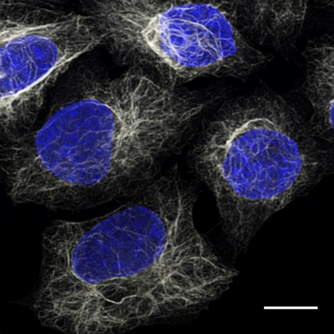 Mouse IgG1 Nano (VHH) Secondary Antibody in Immunocytochemistry (ICC/IF)