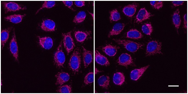 Mouse IgG1 Nano (VHH) Secondary Antibody in Immunocytochemistry (ICC/IF)