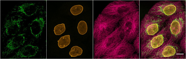 Mouse IgG2b Nano (VHH) Secondary Antibody in Immunocytochemistry (ICC/IF)