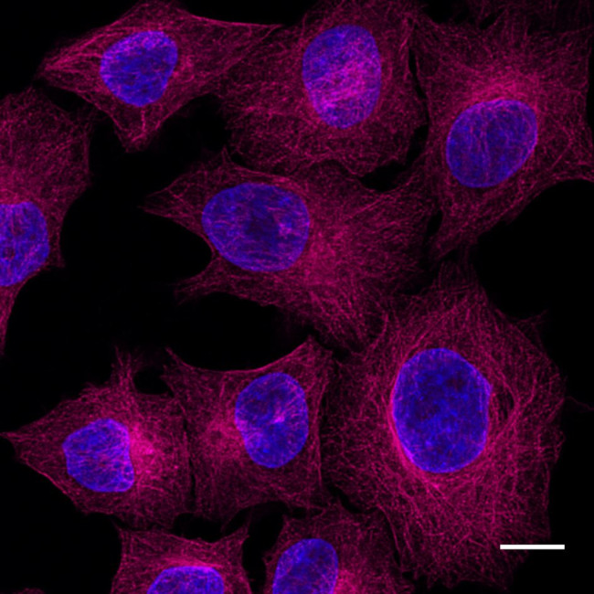 Mouse IgG2b Nano (VHH) Secondary Antibody in Immunocytochemistry (ICC/IF)