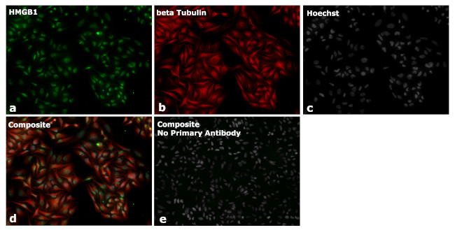 Mouse IgG2a Secondary Antibody in Immunohistochemistry (Paraffin) (IHC (P))