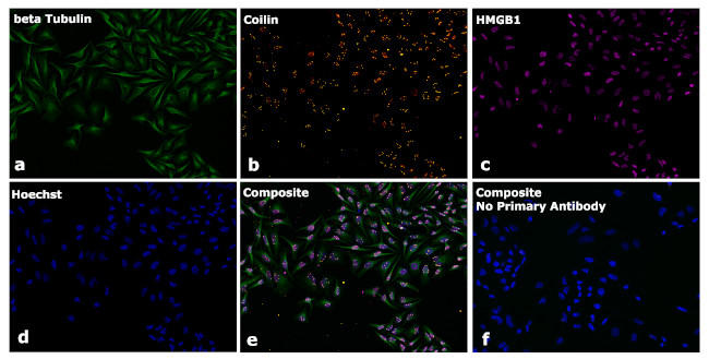 Mouse IgG2a Secondary Antibody in Immunocytochemistry (ICC/IF)