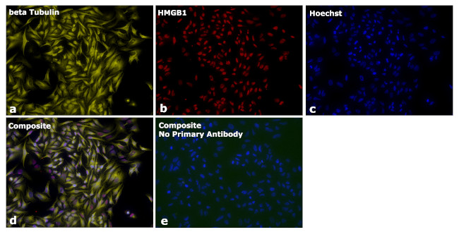 Mouse IgG2a Secondary Antibody in Immunocytochemistry (ICC/IF)