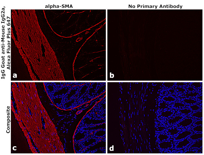 Mouse IgG2a Secondary Antibody in Immunohistochemistry (Paraffin) (IHC (P))