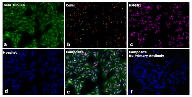 Mouse IgG2a Secondary Antibody in Immunocytochemistry (ICC/IF)