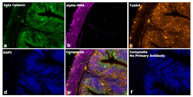 Mouse IgG2a Secondary Antibody in Immunohistochemistry (Paraffin) (IHC (P))