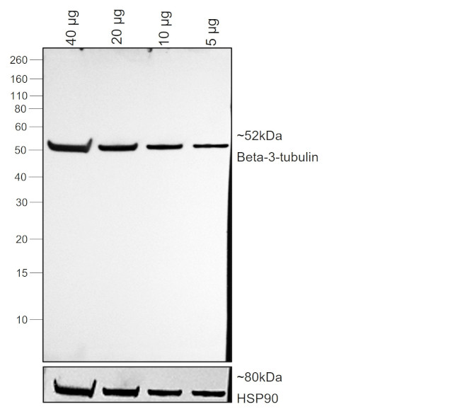 Mouse IgG2a Secondary Antibody in Western Blot (WB)