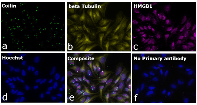 Mouse IgG2a Secondary Antibody in Immunocytochemistry (ICC/IF)