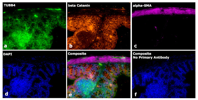 Mouse IgG2a Secondary Antibody in Immunohistochemistry (Paraffin) (IHC (P))