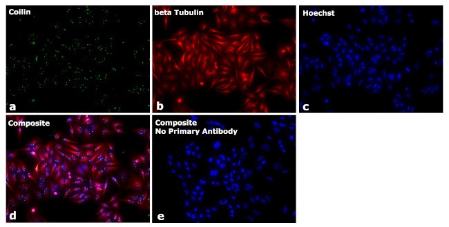 Mouse IgG2b Secondary Antibody in Immunocytochemistry (ICC/IF)