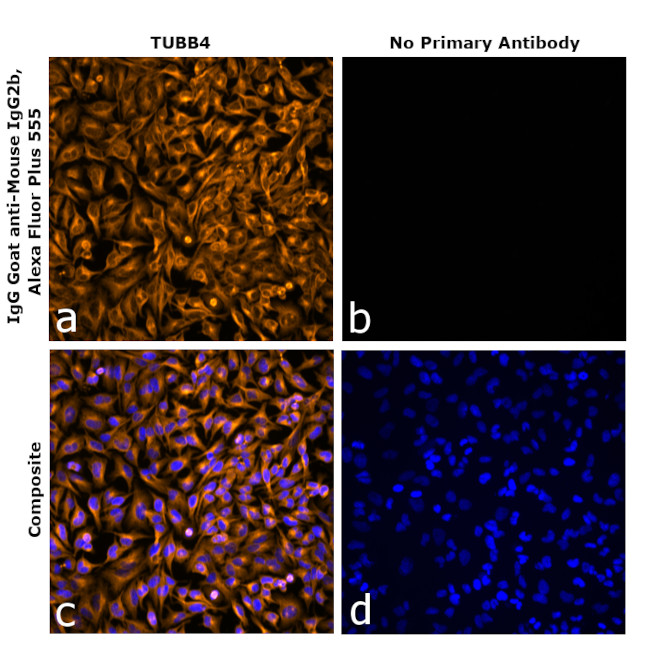 Mouse IgG2b Secondary Antibody in Immunocytochemistry (ICC/IF)