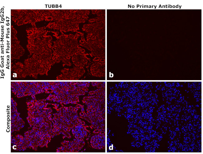 Mouse IgG2b Secondary Antibody in Immunohistochemistry (Paraffin) (IHC (P))