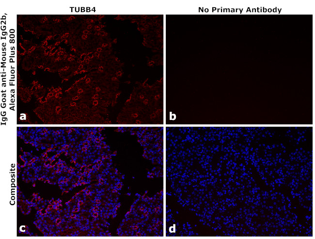 Mouse IgG2b Secondary Antibody in Immunohistochemistry (Paraffin) (IHC (P))