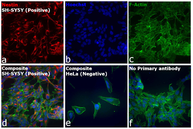 Mouse IgG (H+L) Secondary Antibody in Immunocytochemistry (ICC/IF)