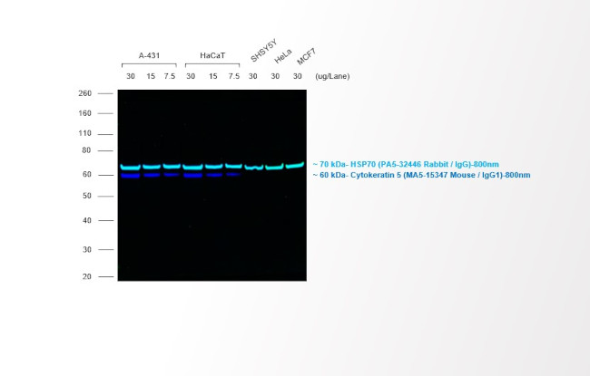 Mouse IgG (H+L) Secondary Antibody in Western Blot (WB)