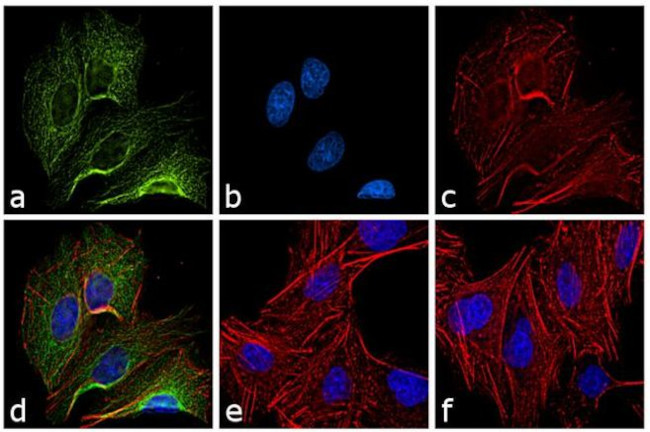 Rat IgG (H+L) Cross-Adsorbed Secondary Antibody in Immunocytochemistry (ICC/IF)