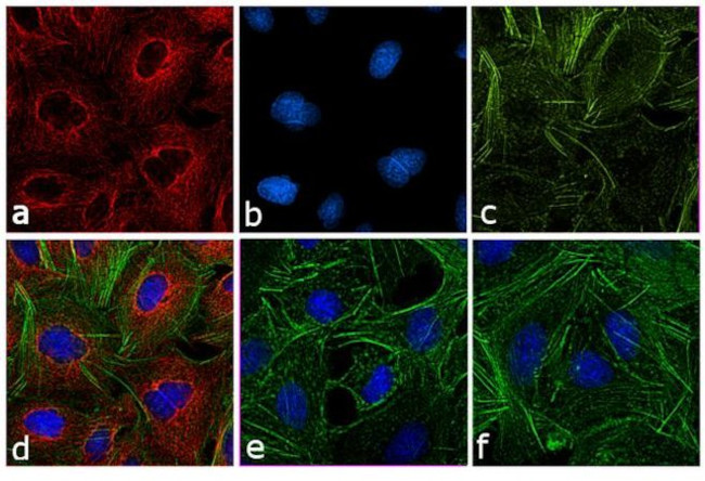 Rat IgG (H+L) Cross-Adsorbed Secondary Antibody in Immunocytochemistry (ICC/IF)