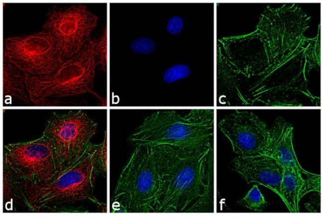 Rat IgG (H+L) Cross-Adsorbed Secondary Antibody in Immunocytochemistry (ICC/IF)