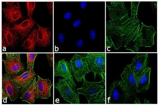 Rat IgG (H+L) Cross-Adsorbed Secondary Antibody in Immunocytochemistry (ICC/IF)