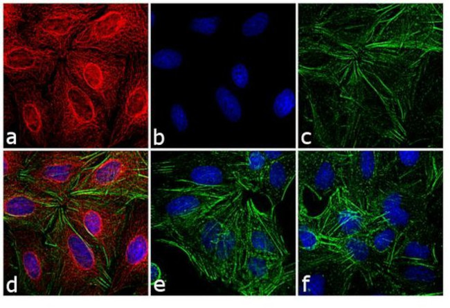 Rat IgG (H+L) Cross-Adsorbed Secondary Antibody in Immunocytochemistry (ICC/IF)