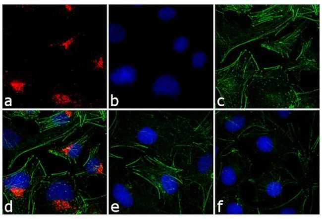 Rabbit IgG (H+L) Cross-Adsorbed Secondary Antibody in Immunocytochemistry (ICC/IF)