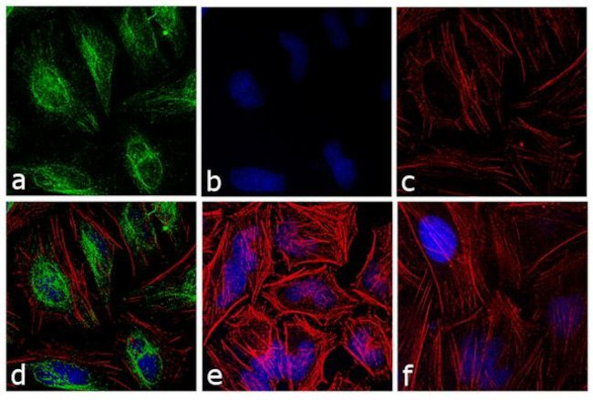 Rabbit IgG (H+L) Cross-Adsorbed Secondary Antibody in Immunocytochemistry (ICC/IF)