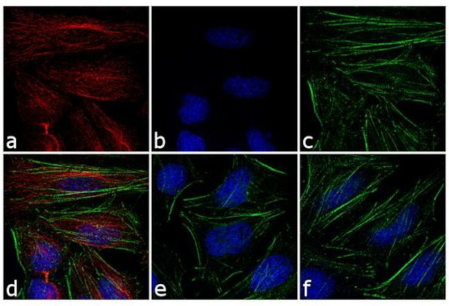 Rabbit IgG (H+L) Cross-Adsorbed Secondary Antibody in Immunocytochemistry (ICC/IF)