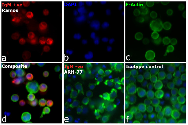 Human IgM Cross-Adsorbed Secondary Antibody in Immunocytochemistry (ICC/IF)