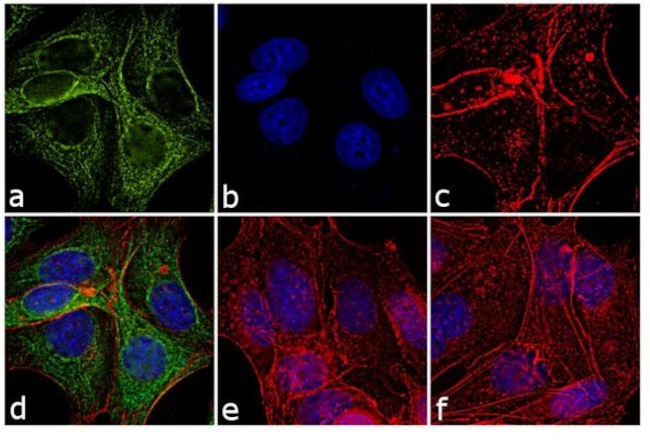 Mouse IgG (H+L) Cross-Adsorbed Secondary Antibody in Immunocytochemistry (ICC/IF)