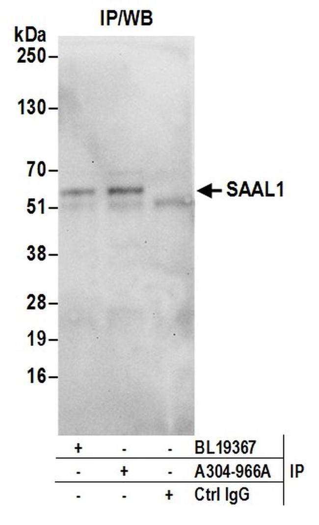 SAAL1 Antibody in Western Blot (WB)