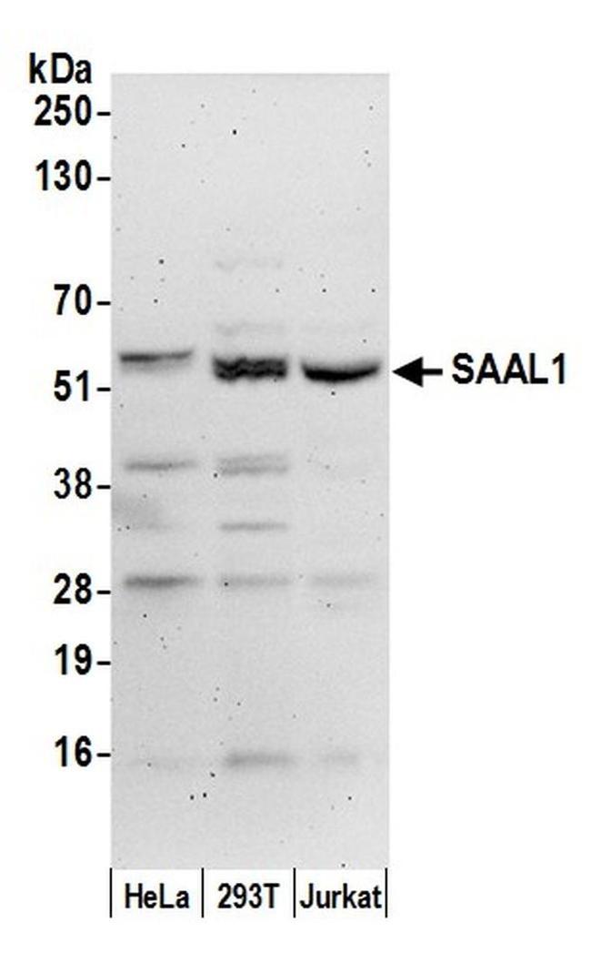 SAAL1 Antibody in Western Blot (WB)