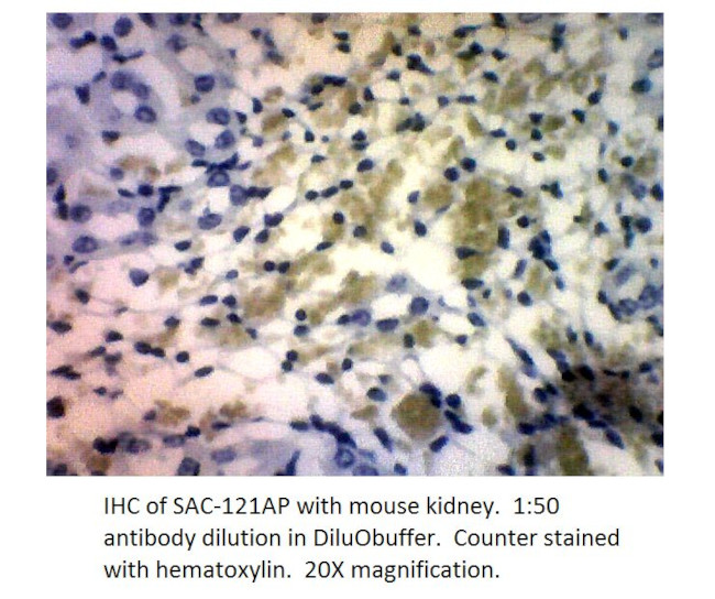 Soluble Adenylate Cyclase 1 Antibody in Immunohistochemistry (IHC)