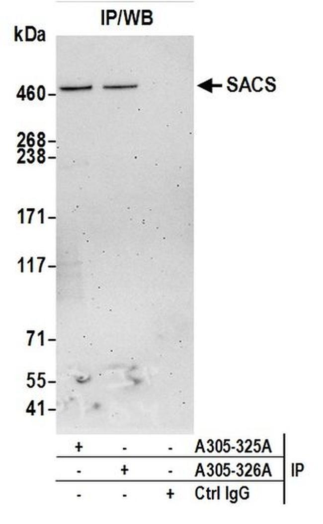 SACS Antibody in Western Blot (WB)