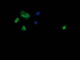 SAE1 Antibody in Immunocytochemistry (ICC/IF)