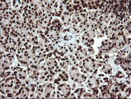 SAE1 Antibody in Immunohistochemistry (Paraffin) (IHC (P))