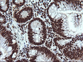 SAE1 Antibody in Immunohistochemistry (Paraffin) (IHC (P))