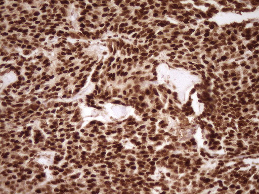 SAE1 Antibody in Immunohistochemistry (Paraffin) (IHC (P))