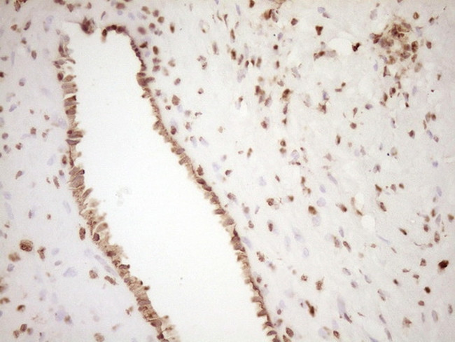 SAE1 Antibody in Immunohistochemistry (Paraffin) (IHC (P))