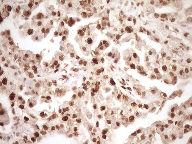 SAE1 Antibody in Immunohistochemistry (Paraffin) (IHC (P))