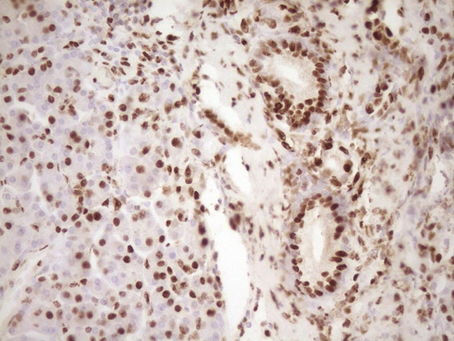 SAE1 Antibody in Immunohistochemistry (Paraffin) (IHC (P))