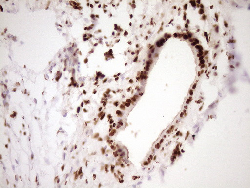 SAE1 Antibody in Immunohistochemistry (Paraffin) (IHC (P))