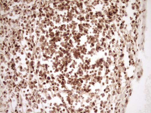 SAE1 Antibody in Immunohistochemistry (Paraffin) (IHC (P))