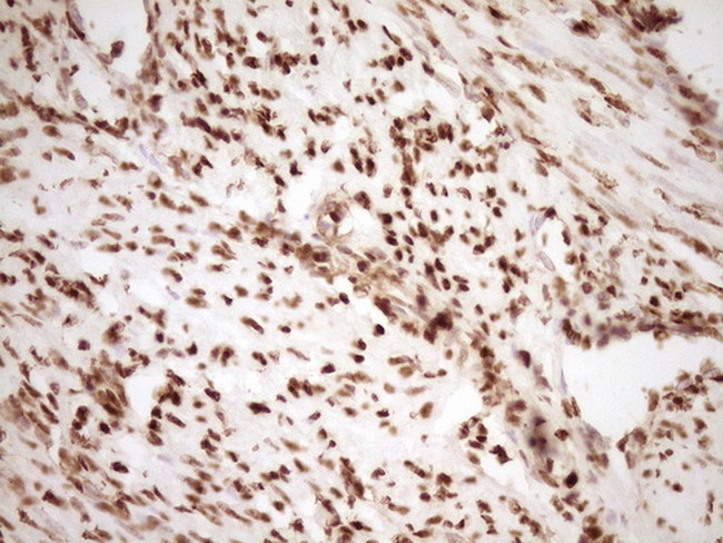 SAE1 Antibody in Immunohistochemistry (Paraffin) (IHC (P))