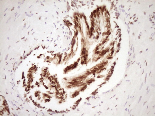 SAE1 Antibody in Immunohistochemistry (Paraffin) (IHC (P))