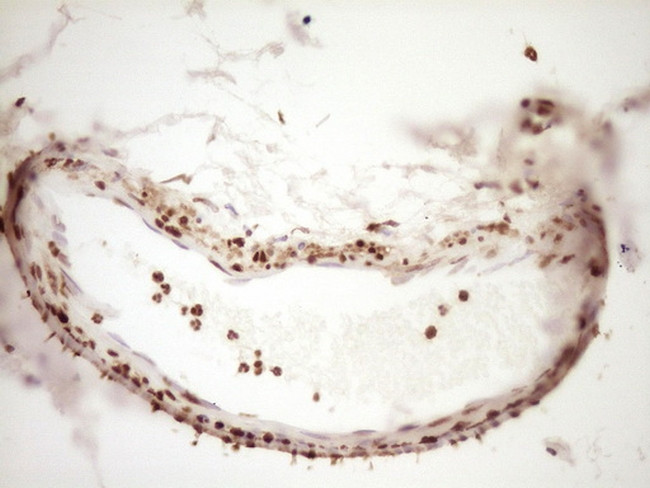 SAE1 Antibody in Immunohistochemistry (Paraffin) (IHC (P))