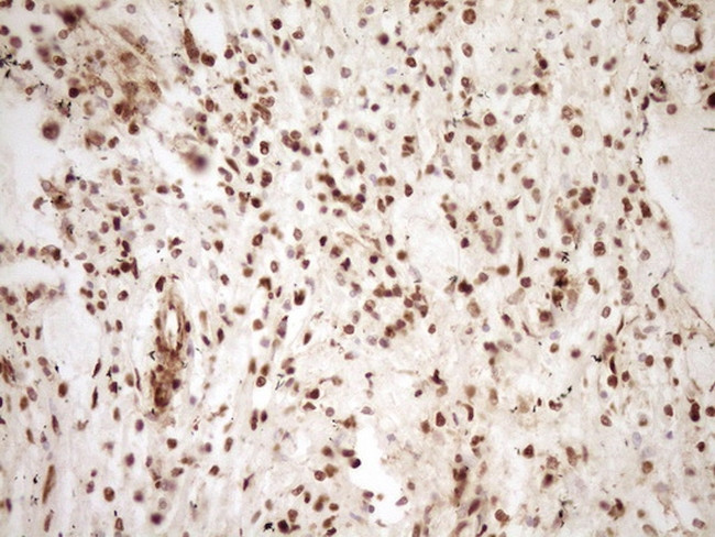 SAE1 Antibody in Immunohistochemistry (Paraffin) (IHC (P))