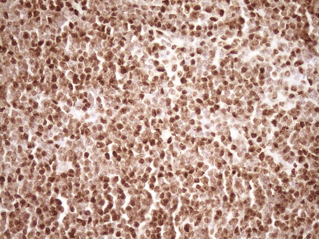 SAE1 Antibody in Immunohistochemistry (Paraffin) (IHC (P))