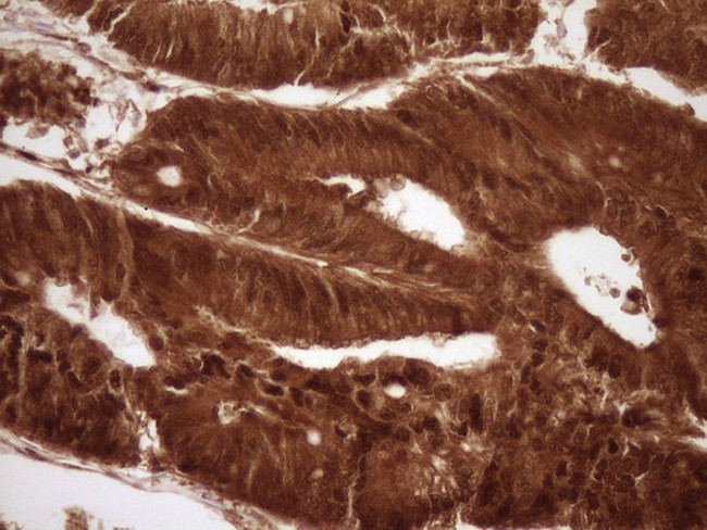 SAE1 Antibody in Immunohistochemistry (Paraffin) (IHC (P))