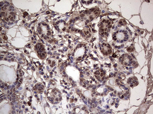 SAE1 Antibody in Immunohistochemistry (Paraffin) (IHC (P))